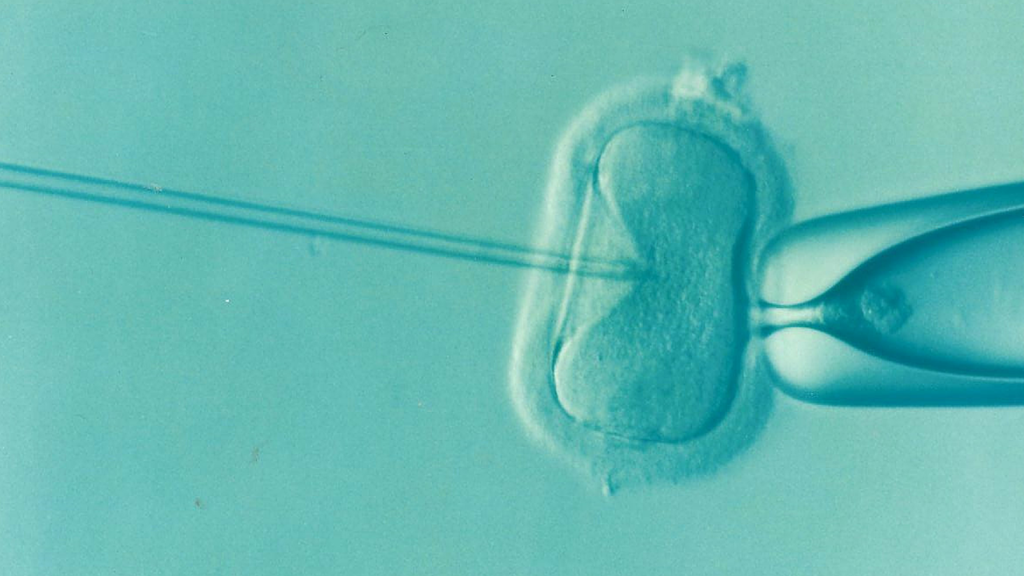 ivf 1514174 1280